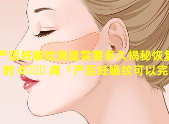 产后妊娠纹消退需要多久揭秘恢复时 🐛 间「产后妊娠纹可以完全消除吗」